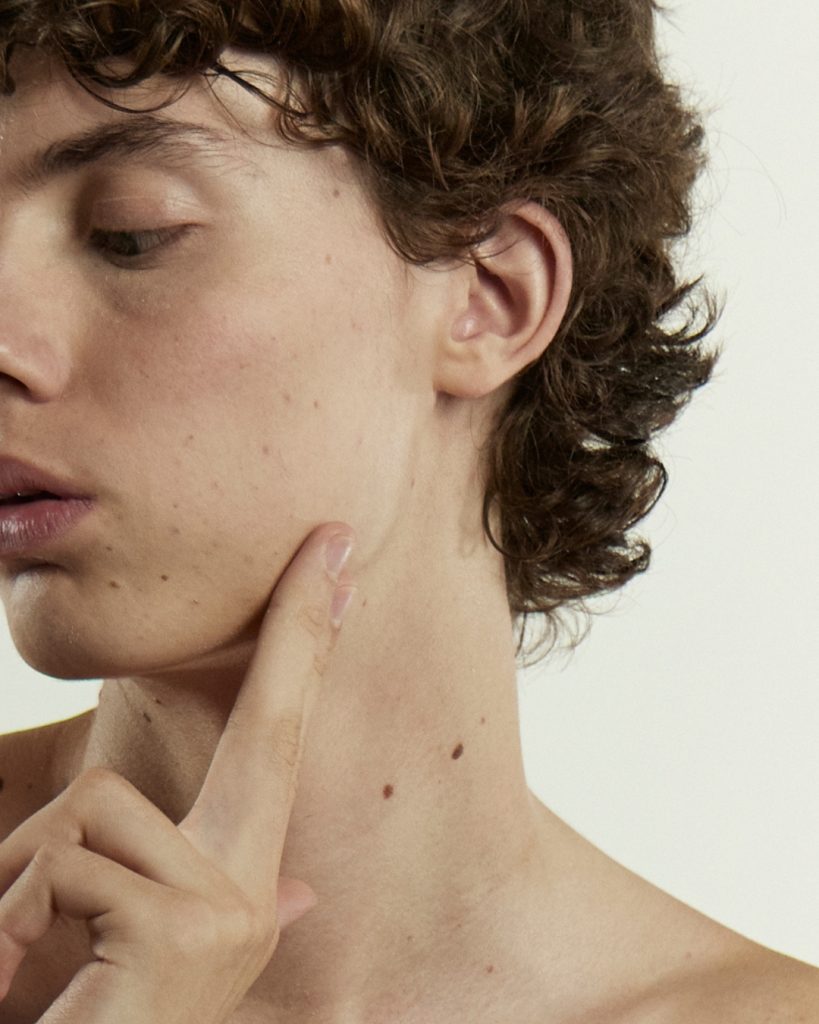 Acne adulta: cause, errori comuni e perché scegliere una skincare essenziale